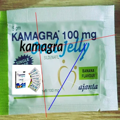 Acheter kamagra pas cher